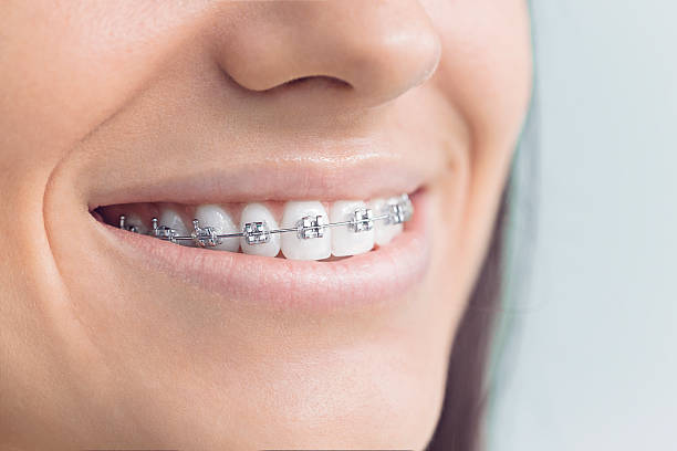 Best Full Mouth Reconstruction  in Royal City, WA
